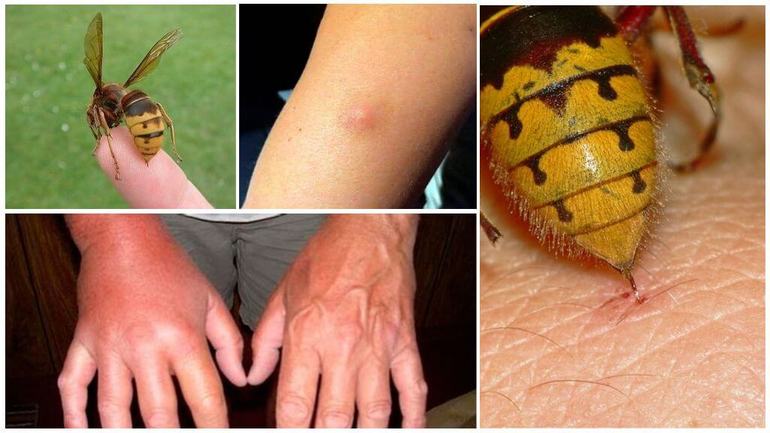 El peligro de un avispón para los humanos.