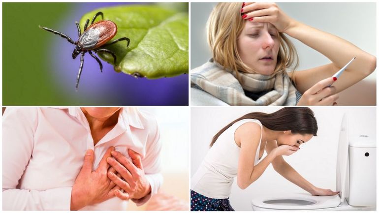 Encefalitis: una infección que afecta el cerebro.