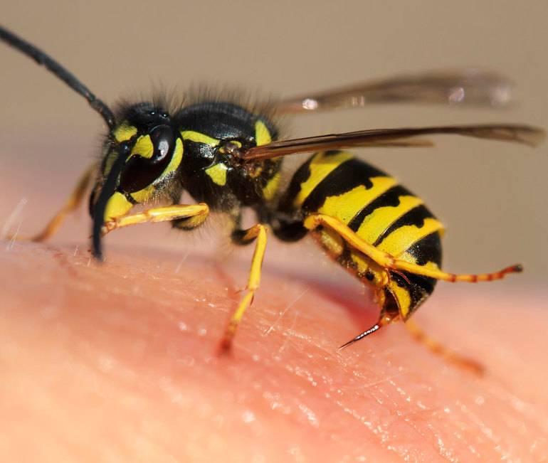 Picaduras de avispa