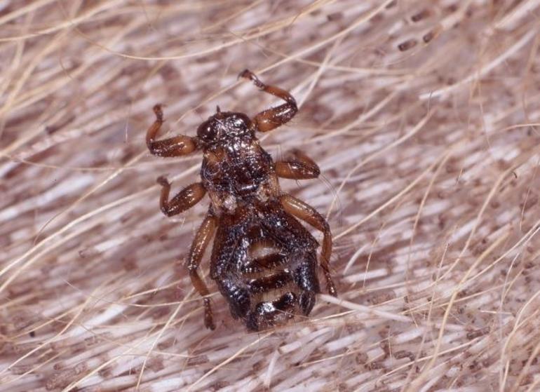 Sanguijuelas de ciervo