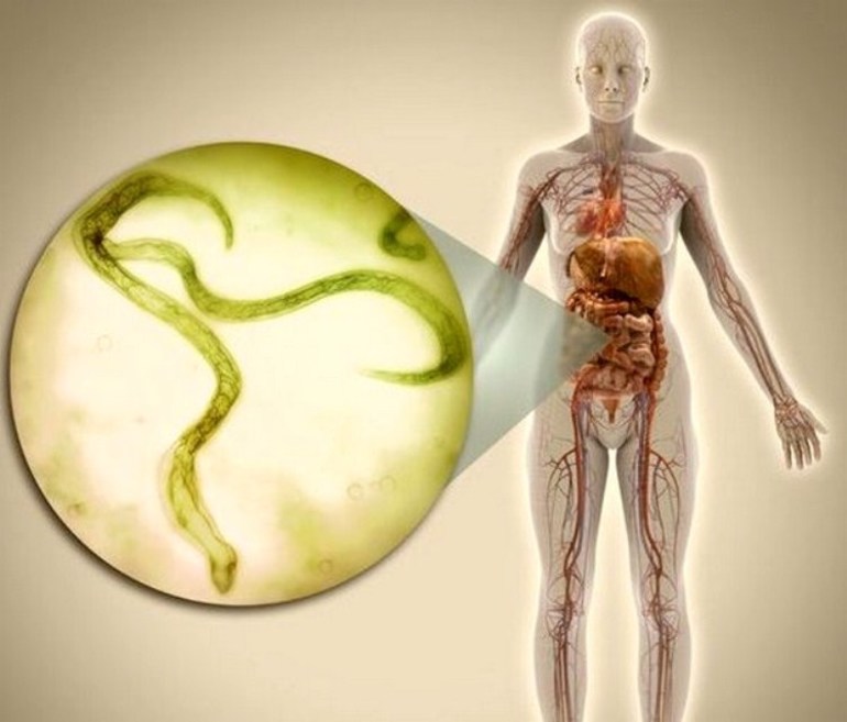 Tenia en el cuerpo humano